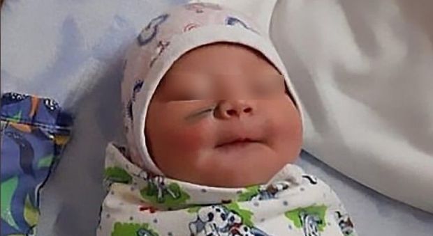 Errore durante il cesareo, i medici feriscono al volto la neonata: «Non avrebbe dovuto muoversi»