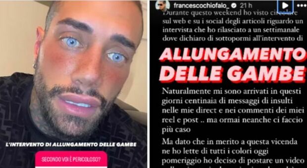 Francesco Chiofalo, dopo gli occhi l’operazione per allungare le gambe: «Secondo voi è pericoloso?»