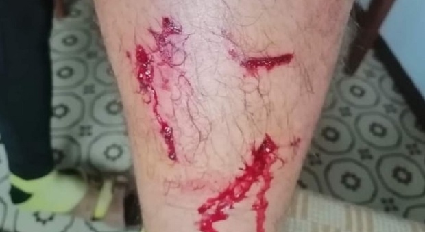 Le ferite riportate dal ciclista aggredito dai cani