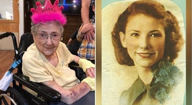 Visse sino a 99 anni con gli organi invertiti, Rose Marie non lo ha mai saputo