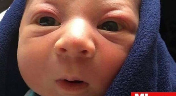 Meningite, muore neonato di 2 mesi: "Non aveva alcun sintomo"