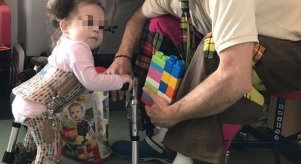 Jo, 2 anni, rischia l'amputazione per una malformazione alle gambe. I genitori: «Servono 500mila euro, aiutateci»