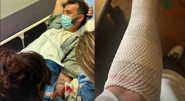Salmo in ospedale dopo un brutto incidente: «Ho rischiato di perdere il braccio»