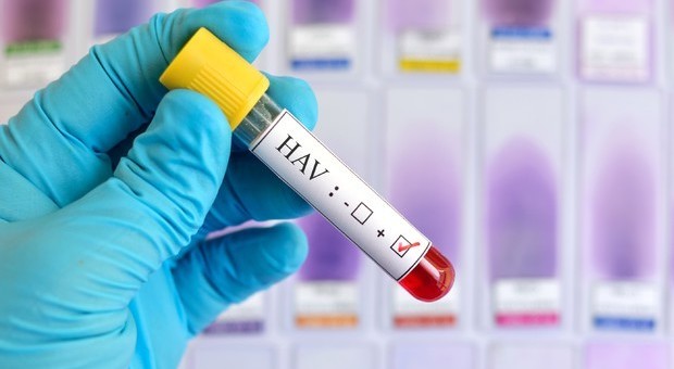 Epidemia di Epatite A, almeno 14 morti a San Diego: choc in Usa