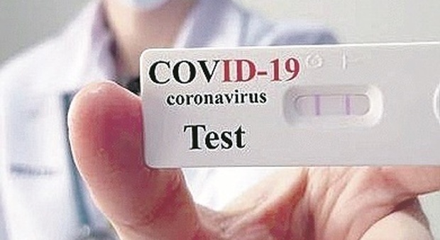 Nelle farmacie delle Marche 600 test sierologici in pochi giorni: il 3% positivo al Covid