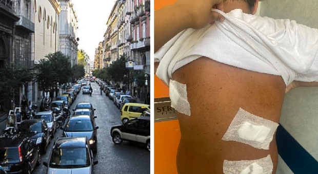 Checco, 14 anni, accoltellato a Napoli davanti alla fidanzatina: «Volevano il mio bracciale»