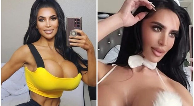 Malore per la sosia di Kim Kardashian dopo un intervento di chirurgia plastica: morta a 34 anni