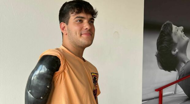 Davide Dalpane, 19 anni: «Grazie al braccio bionico diventerò professore di educazione fisica»