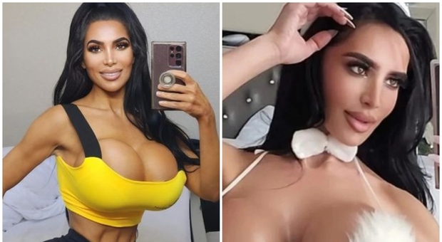 Sosia di Kim Kardashian muore d'infarto dopo un intervento di chirurgia plastica: l'influencer aveva 34 anni
