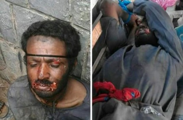 Yemen, rapiva cani e ne beveva il sangue: arrestato il "vampiro"