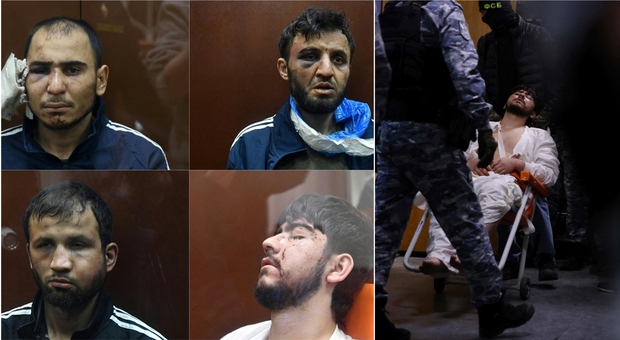 Attentato, chi sono i 4 tagiki arrestati (e torturati): i volti gonfi, i lividi, i tagli, uno di loro in sedia a rotelle