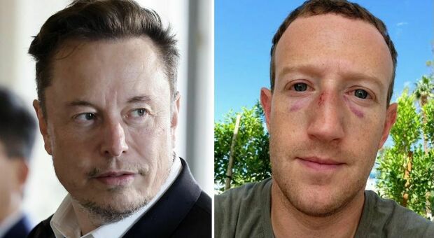 Musk contro Zuckerberg? La foto con i lividi che scatena i dubbi sui social e riaccende le speranze