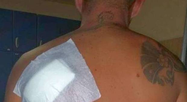 Pregiudicato ferito posta le foto su Facebook e minaccia i suoi assalitori. La polizia lo arresta