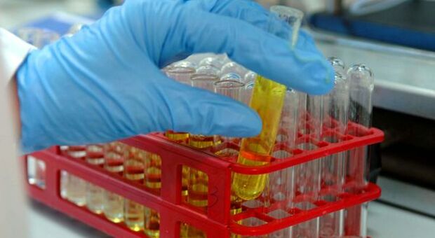 Coronavirus, Sanofi blocca farmaco Kevzara: "Test falliti"