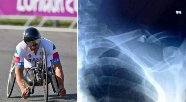 Alex Zanardi si schianta in handbike sui Colli Euganei e si frattura una spalla