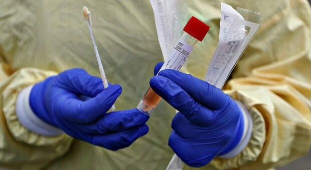 Test sierologici, arrivano i kit destinati ai prof: migliaia pronti a sottoporsi all'esame prima dell'inizio dell'anno scolastico