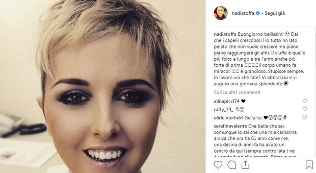 Nadia Toffa si mostra senza parrucca: «Ho un lato pelato che non vuole riscrescere»