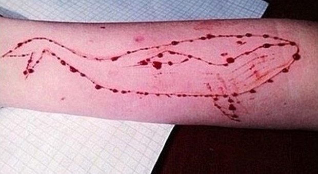 Torna l'allarme Blue Whale, 20enne trovata con tagli al braccio: si indaga per istigazione al suicidio