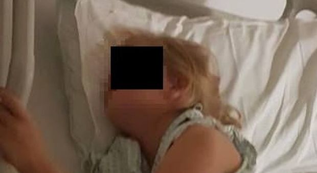 Presa di mira dai bulli, tenta il suicidio a 10 anni: mamma mostra le foto choc