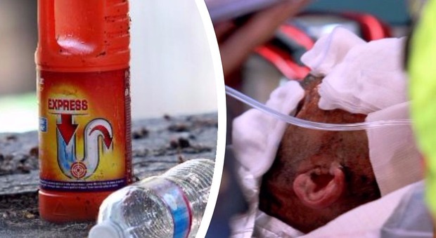 Un uomo di 43anni aggredito al volto con acido in centro a Milano
