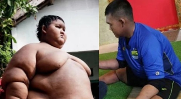 Il 13enne più grasso del mondo perde 100 chili: le foto fanno il giro del web