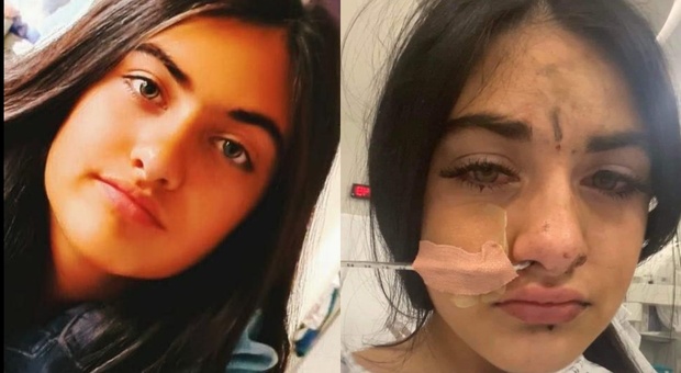 Si uccide a 12 anni dopo uno stupro e l'incontro con la polizia, la mamma pubblica la foto choc in ospedale