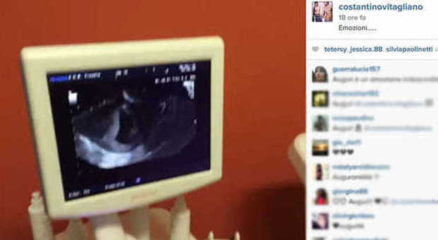 Costantino Vitagliano papà: l’ecografia del bambino in un video su Instagram