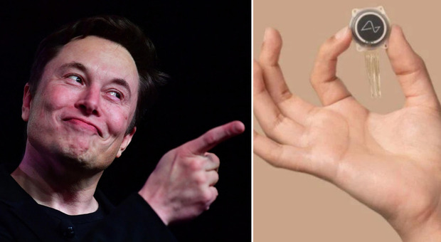Elon Musk: «Il primo paziente riesce a muovere un mouse usando il pensiero grazie a Neuralink»