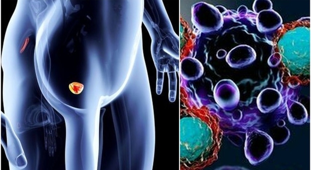 Tumore alla prostata, svelato il meccanismo che lo favorisce: ecco le cellule attraverso le quali si sviluppa la malattia