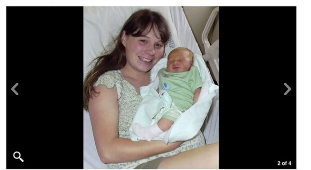 Mamma 41enne aveva un ago nella schiena: "Dimenticato per 14 anni dopo l'epidurale"