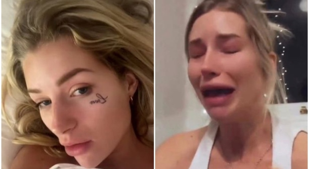 La sorella di Kate Moss si ubriaca e si fa tatuare 'amante' in faccia. Poi si pente: «Meglio non bere troppo»