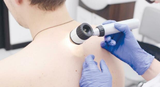 Dermatite atopica: nuova terapia sperimentale anche all'ospedale di Torrette