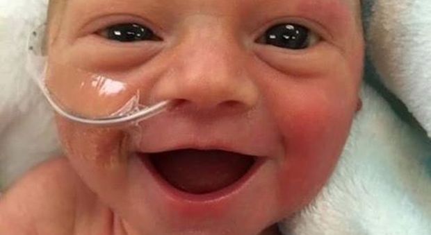 Nasce prematura e sottopeso, ma la foto del suo sorriso su Facebook diventa virale