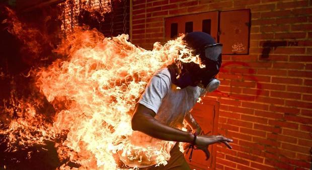 World Press Photo, lo scatto vincitore è un ragazzo avvolto dalle fiamme: in mostra a Roma dal 27 aprile