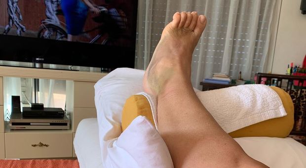 Mara Venier e il piede dolorante: «Dopo tre settimane... ancora così»