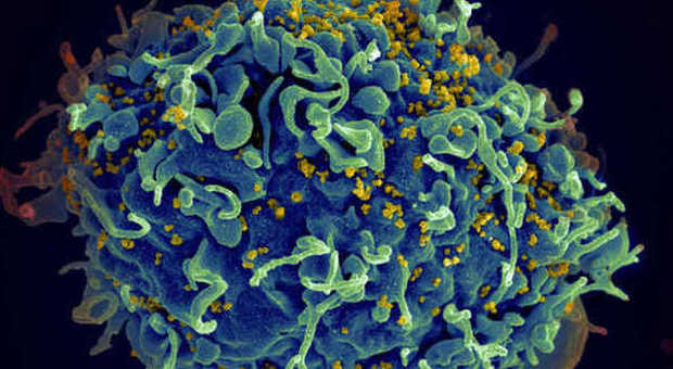 Scoperto dove si nasconde il virus Hiv nelle cellule: da una ricerca italiana la svolta per la lotta all'Aids?
