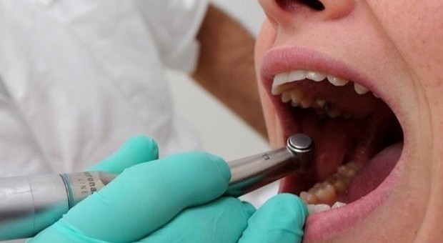 Dentista dà fuoco alla bocca di una bambina di 5 anni: ricoverata in ospedale