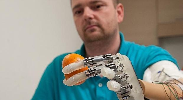 Dito bionico ridona il tatto a un amputato grazie a un polpastrello artificiale