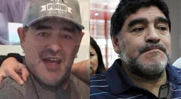 Maradona, un «ritocchino» facciale a 54 anni?