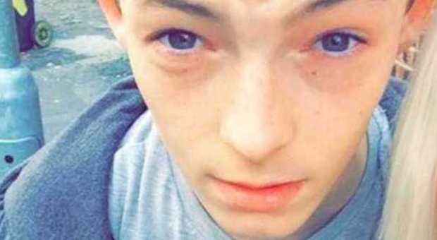 Ucciso a 17 anni mentre ballava il Gangnam Style: è morto sbattendo la testa sul marciapiede