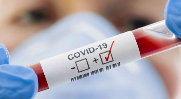«Covid-19, mortalità inferiore a quella dell'influenza». Studio sui test sul sangue in Giappone
