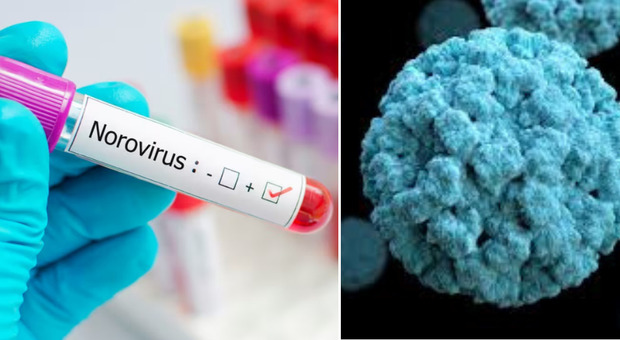 Novovirus, sale l'allarme in Italia: sintomi (diarrea, vomito e crampi addominali), trasmissione e cura per il virus intestinale. La guida