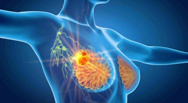 Tumore al seno, in Italia 6mila casi all'anno per l'abuso di alcol. Gli oncologi: «L'etanolo è più tossico per le donne»