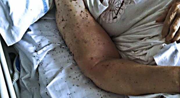 Napoli: formiche nell'ospedale San Paolo, corsie sporche anche durante il lockdown