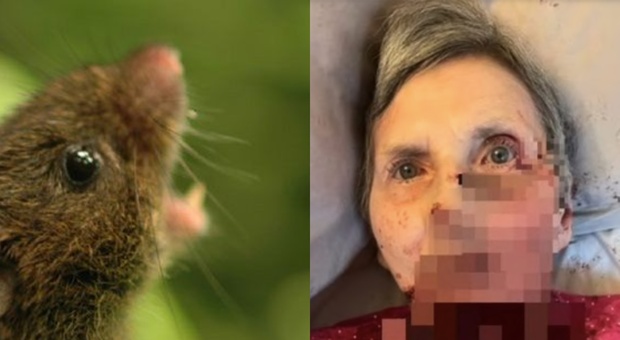 Disabile e allettata in un lago di sangue: «Un topo le ha mangiato la faccia fino all'osso»