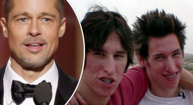 I gemelli che hanno speso 15mila dollari per assomigliare a Brad Pitt