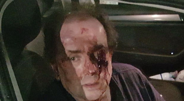 Tassista massacrato di botte da un passeggero: «Pensavo di morire»