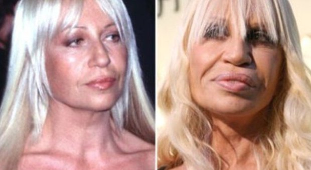 Da Pamela Anderson a Mickey Rourke, quando la chirurgia plastica fa flop