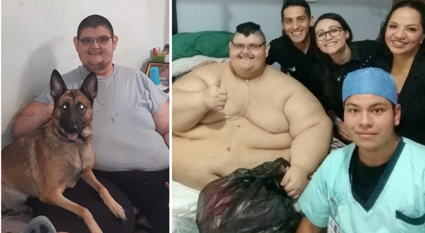 L'uomo più grasso al mondo ha perso 300 chili: ecco com'è oggi