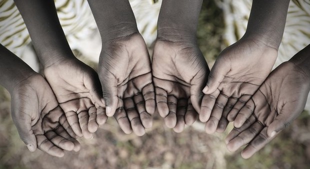 Epidemia di morbillo in Congo: oltre cinquemila morti. I bambini sotto i cinque anni i più colpiti: «Peggio dell'ebola»